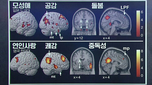 "전 연인 고통이 곧 쾌감" 마약 중독자 뇌처럼 돌변 [이과적 사고]