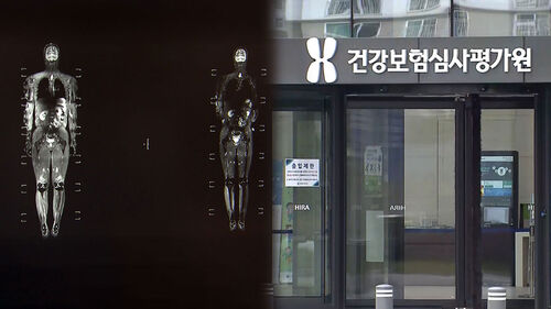 [시선360] 국내만 6천여 명…유일 치료제 보험 적용 골머리