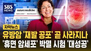 [자막뉴스] 유방암 '재발 공포' 곧 사라지나&hellip;'휴면 암세포' 박멸 시험 '대성공'