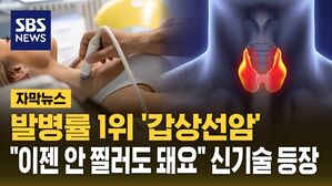 [자막뉴스] 발병률 1위 '갑상선암'&hellip;"이젠 안 찔러도 돼요" 신기술 등장