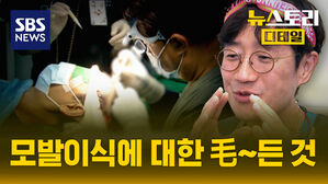 뉴스토리 디테일 탈모