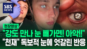 [현장영상] "강도 만나면 어쩌려고!" 눈에 2캐럿 다이아몬드가 박혀 있다?