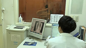 국가 암 검진 이상 발견 뒤 후속 진료율, 대장암 높고 간암 낮아