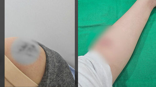 [사건X파일] 교사의 성희롱…"넌 가슴 크지 않으니"