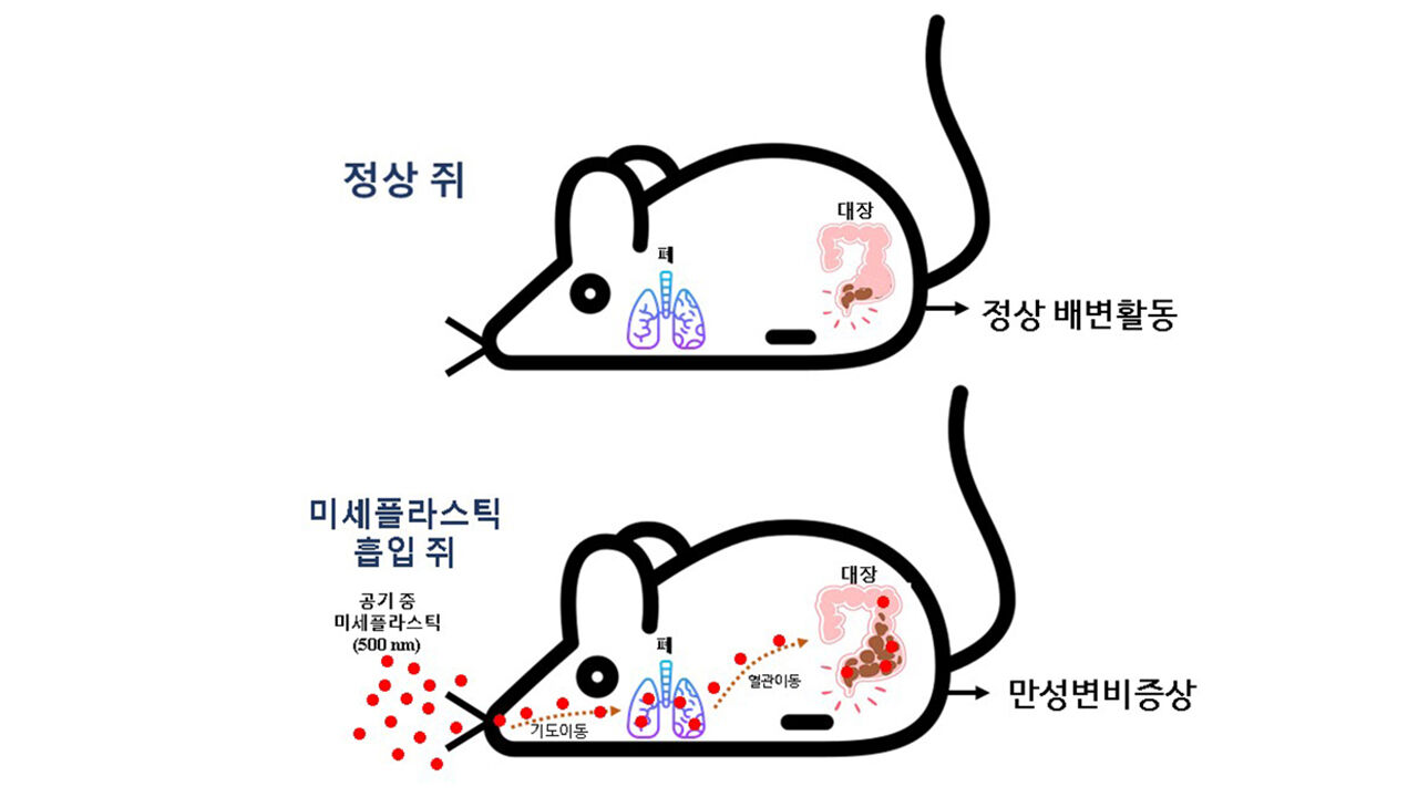 공기 흡입 미세플라스틱, 대장 이동 변비 유발 가능성