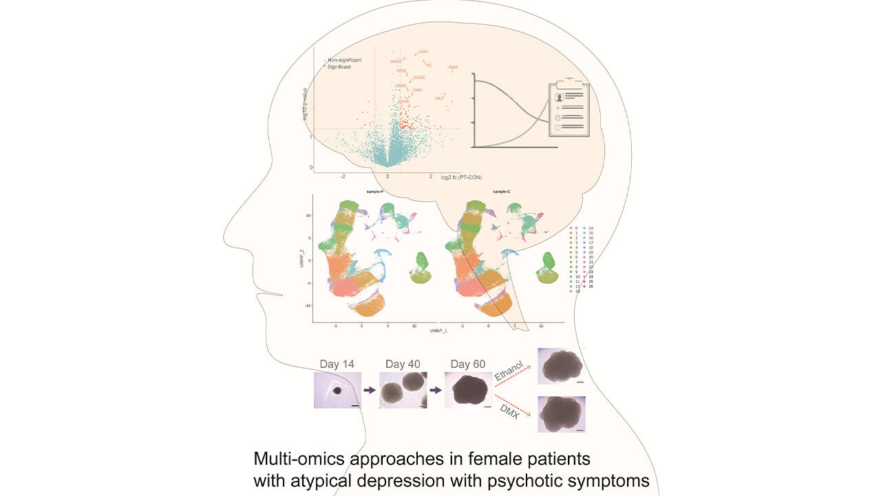 KAIST "'마음의 병' 우울증, 몸 전체 면역반응 이상과도 연관"