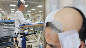 [사건X파일] 2만 볼트 감전 후 생존…"죽을 줄 알았나" 가족의 배신