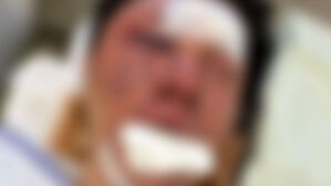 "뒷사람만 봐도 쿵쿵"…100만 유튜버가 밝힌 납치 당시