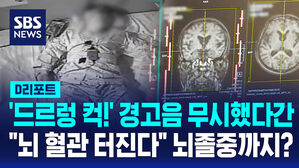 [D리포트] '드르렁 컥!' 수면 무호흡 무시했다간&hellip;"뇌혈관 터진다" 뇌졸중까지?