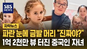 [자막뉴스] "우리 애 맞아?" 부모도 의심&hellip;백인 딸 낳은 중국인 부부