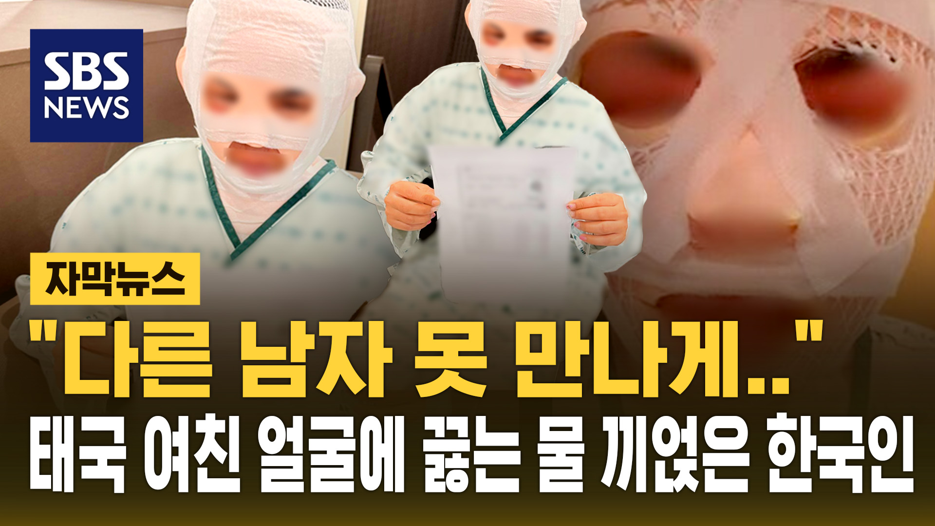 [자막뉴스]  다른 남자 못 만나게 …잠자는 태국 여친</font> 얼굴에 끓는 물 부은 한국인