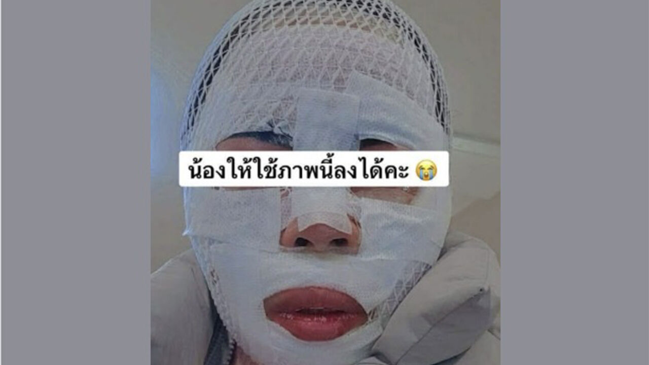 태국인 아내에 끓는물 부은 40대…경찰 조사받자 "실수였다"