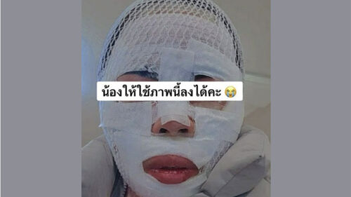 "못생겨져라" 아내에 끓는 물…경찰 조사받자 "실수였다"