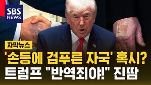 [자막뉴스] '손등에 검푸른 자국' 혹시? 트럼프 "반역죄야!" 진땀