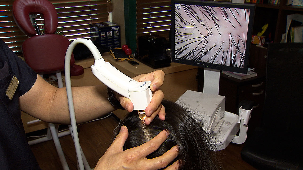 [친절한 경제] "미용 아닌 생존의 문제"&hellip;탈모도 건강보험 적용?