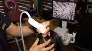 [친절한 경제] "미용 아닌 생존의 문제"&hellip;탈모도 건강보험 적용?