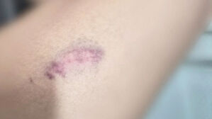 [사건X파일] 성탄절 마트 갔다가&hellip;주차장서 주먹질 봉변