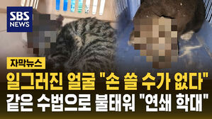 [자막뉴스] 일그러진 얼굴 "손 쓸 수가 없다"&hellip;같은 수법으로 불태워 "연쇄 학대"