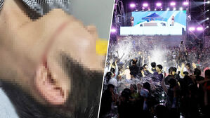 물축제 중 찢어진 얼굴&hellip;"수개월째 사과 없어" 결국