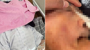 "이건 범죄" 요양병원 충격 장면&hellip;노모 어떻게 있었길래