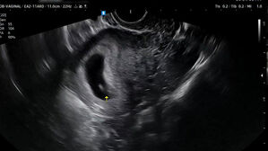 [사건X파일] 멀쩡한 태아 "긁어내라" 오진&hellip;아기 잃을 뻔한 부부