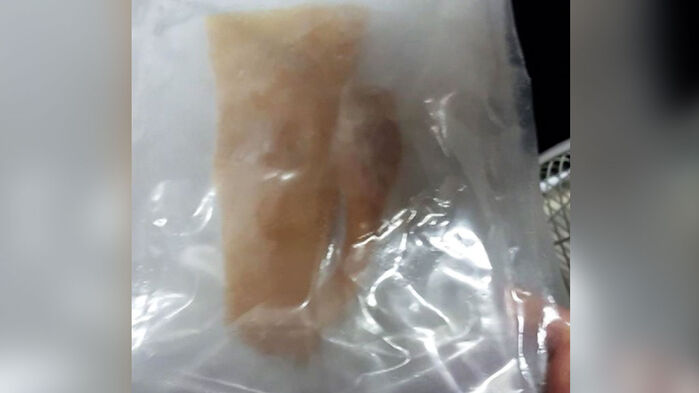 반쪽 아킬레스건 납품 일당 무혐의 논란