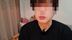 "턱 뾰족하게 하려다&hellip;" 성형 후 인생 망친 모델 그후