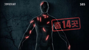 형 사망 뒤 14차례 찔린 아버지&hellip;패륜범 뒤엔 '구하라 법'?