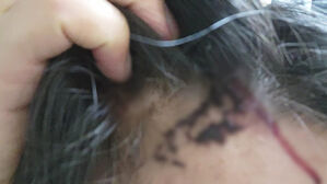 돈 100만 원이 뭐길래&hellip;돌로 머리 찍어 피 '철철'