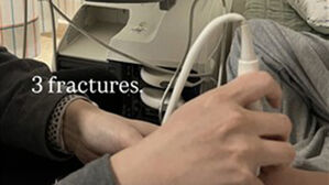 최가온, 이 정도 고통 참고 금메달 땄나&hellip;병원 검진 결과