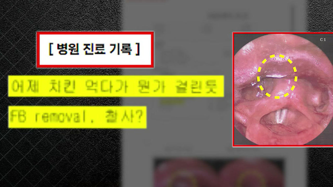 유명 치킨 먹고 목에 걸린 '철심'