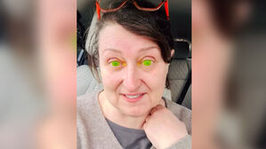 안과 다녀온 뒤 "전부 초록색"&hellip;거울 본 여성 '기겁'