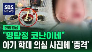 [현장영상] "명탐정 코난?" 다정한 SNS 사진 속 반전, 엄마의 아동 학대 의심에