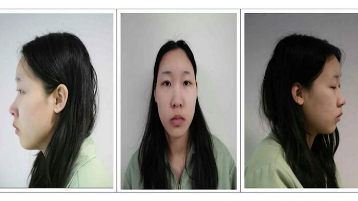 모텔 연쇄살인 사건 피의자 20세 김소영