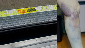 지하철 타려다가 날벼락&hellip;"도와주세요" 결국 '전치 3주'