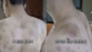 쇠줄로 맞고 머리 밀렸다&hellip;중국집 다락방서 '노예 생활'