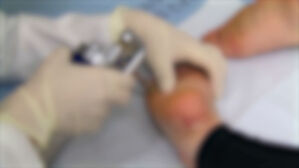 "티눈 수술 2,500번" 타낸 보험금 7억&hellip;결말은