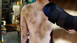 "기절당했을 때 차라리 행복" 돌변한 직장 동료 무슨 일