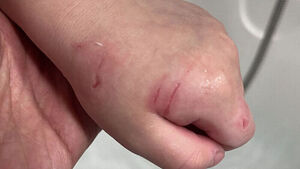 4살 아이 손에 할퀸 자국들&hellip;"피 닦은 휴지 따로 챙겨"