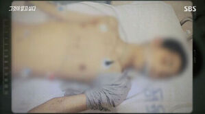 "때리지 않으면 내가 죽어"&hellip;학대 도구 된 형의 절규