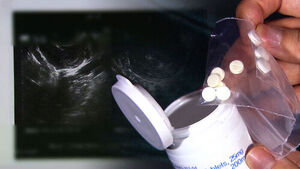 [단독] 약사처럼 "임테기 해보면"&hellip;고3한테도 판 낙태약