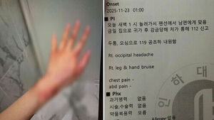 피멍 든 몸 찍고 "미친듯 때렸다"&hellip;걸그룹 친오빠 폭로