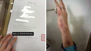 "감금돼 112 신고" 걸그룹 친오빠 폭로&hellip;사진도 꺼냈다