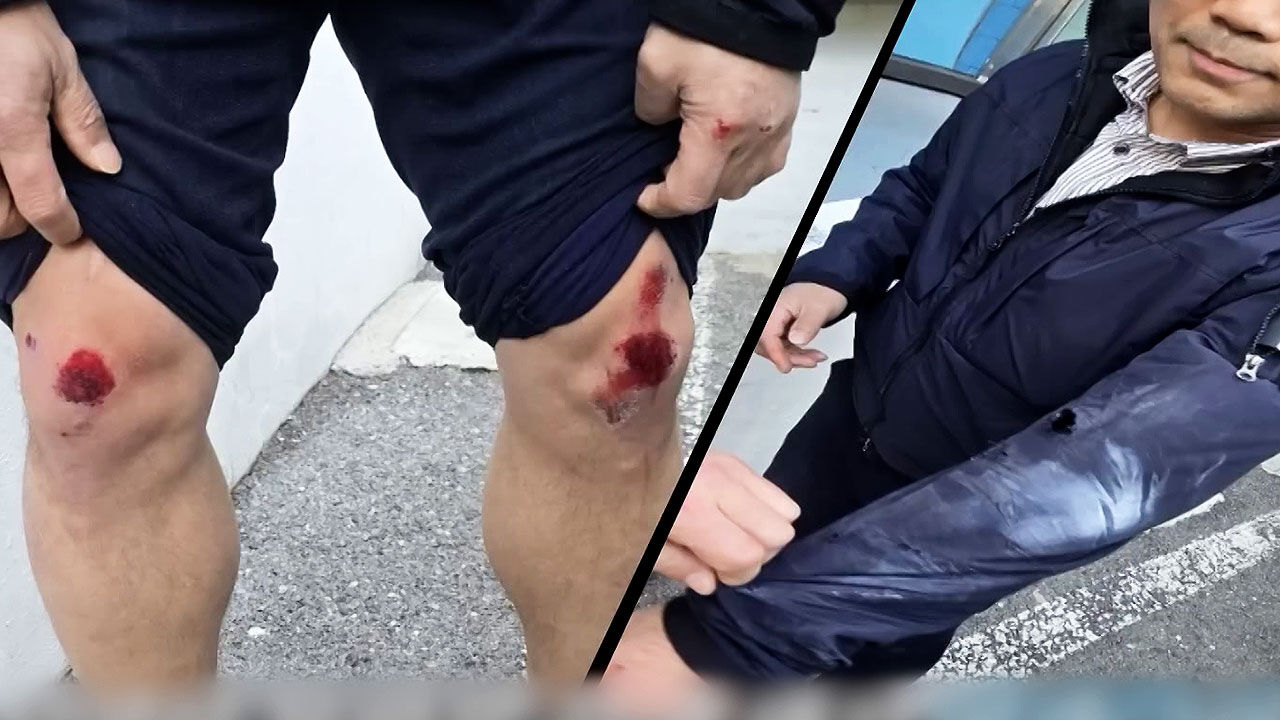 베테랑 형사 무릎 까져도 보이스피싱범 추격