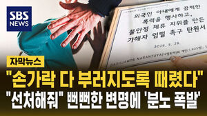 몽땅 부러진 손가락들&hellip;"이러다 죽겠다" 잔혹 폭행