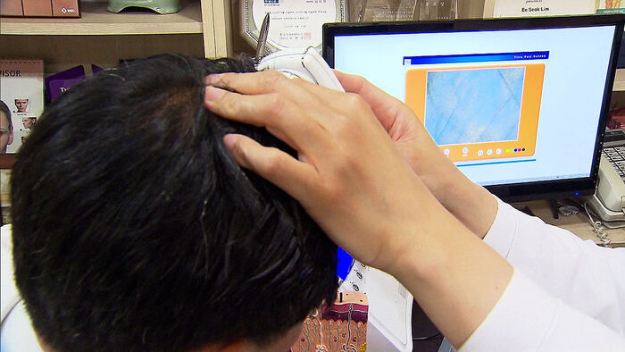 Concerns Over Health Insurance Funds: Is Hair Loss Treatment Coverage Expanding?