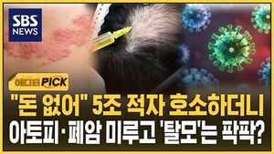 "돈 없어" 5조 적자 호소하더니..아토피&middot;폐암 미루고 '탈모'는 팍팍?