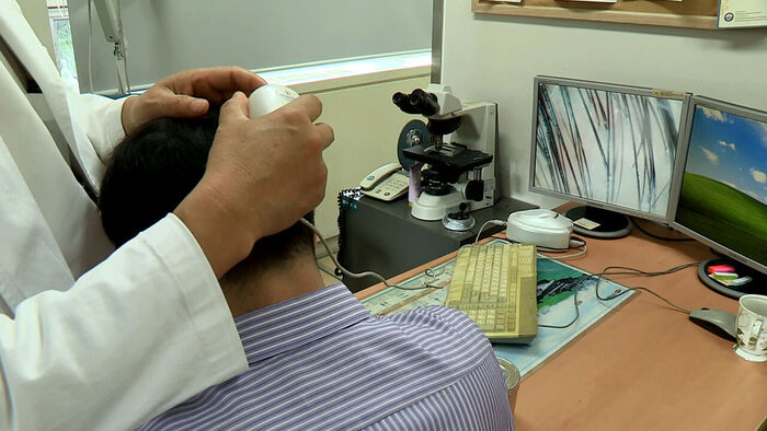 Civil Society Joins Medical Community in Urging Caution Over Health Insurance Coverage for Hair Loss Treatment
