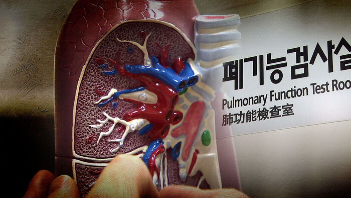 만성폐쇄성폐질환