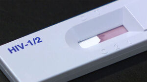 New HIV Infections in South Korea Decline for Third Consecutive Year; Number of Survivors Sees Slight Increase